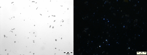 
   
    Figure 9 : Mise en évidence des oxydes d'aluminium dans un acier
   
  