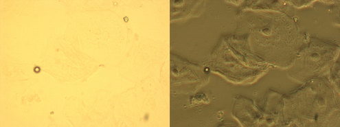 
   
    Figure 11 : Cellules épithelialse en fond clair (a) et en contraste de phase (b), objectif utilisé x40 
   
  